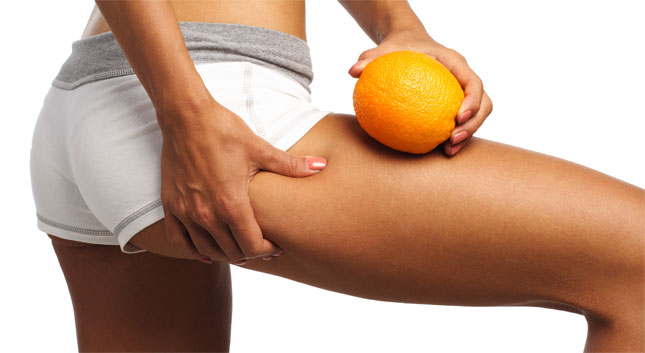Los síntomas de la retención de líquidos y el efecto piel de naranja